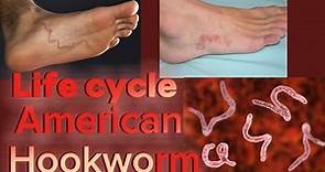 Life Cycle of American Hookworm || Necator Americanus || Phylum Nematoda || (English)