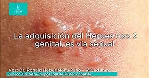 #SaludPresente🩺¿Qué es el Herpes tipo 2 o genital?