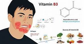 Vitamin B3 : Niacin (sources,metabolism and deficiency)