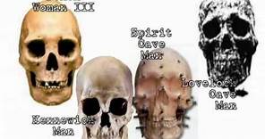 3 Basic Human Skulls