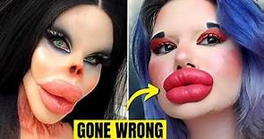 6 Times Plastic Surgery Went Horribly Wrong
