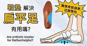 鞋墊解決扁平足有用嗎? | Are orthotic insoles for flatfeet helpful? | F23, F28c, F29