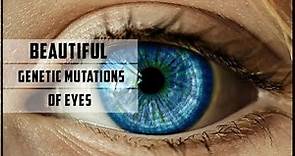 Beautiful genetic mutations of eyes
