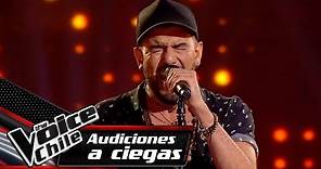 Juan Pablo Lara - Easy | Audiciones a Ciegas | The Voice Chile