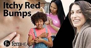 Dermatologist breaks down 7 causes of red itchy bumps | What your rash might be??