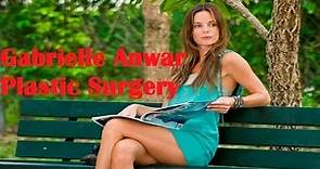 Proof of Gabrielle Anwar Plastic Surgery | Before and After