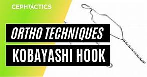 Koyabashi hooks in Orthodontics