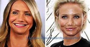 Cameron Diaz Plastic Surgery Before and After HD