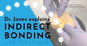 Dr. Jones Explains Indirect Bonding – How it's Made | Jones Family Orthodontics | Monroe, Washington
