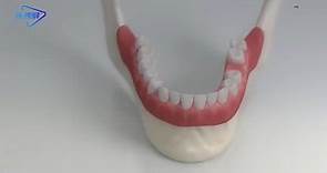 【医学3D】：种植牙的全过程，一看就懂
