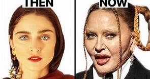 Madonna Plastic Surgeries - Surgeon Reacts