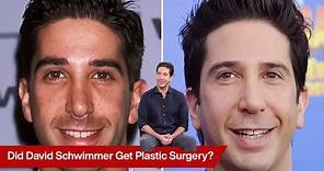Beyond Ross Geller: Exploring David Schwimmer's Plastic Surgery
