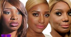 Nene Leakes Transformation and Plastic Surgery | Tinted TV