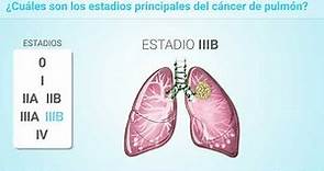 Estadificación del cáncer de pulmón