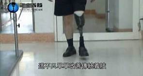 小腿義肢套筒製作原理 正全義肢堅持技術本位