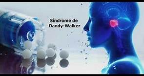 Síndrome de Dandy-Walker