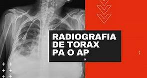 Radiografía de tórax PA o AP. Cual es la proyección que estas viendo?