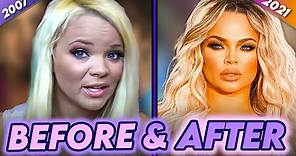 Trisha Paytas | Before & After | Plastic Surgery, Liposuction, Hairstyle & More