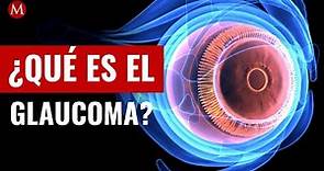 ¿Qué es el glaucoma, cuáles son los síntomas y cómo se trata?