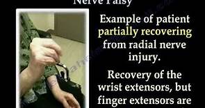 Radial Nerve Palsy ,Recovering . Part II- Everything You Need To Know - Dr. Nabil Ebraheim