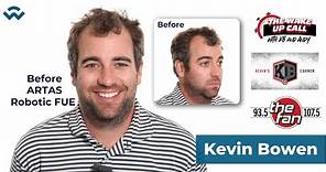 Introducing Kevin Bowen - We Grow Hair Indy's Newest VIP Hair Transplant Client