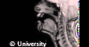 MRI voiced dental fricative