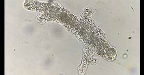 Amoeba movement with pseudopodia under a microscope
