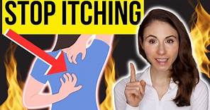 HOW TO STOP ITCHING ON THE BACK | Notalgia Paresthetica
