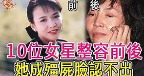 10位香港女星整容前後，有人成殭屍臉有人越來越美，萬萬沒想到她也動過鼻子#郭可盈#鄭裕玲#李彩樺#黃金年代