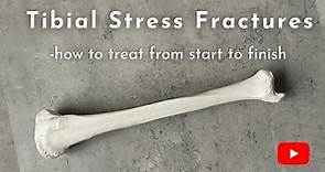 Tibial Stress Fractures | Causes, Diagnosis, and Treatment
