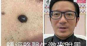 （HK 9,000）皮膚科碩士醫生鍾經略示範激光脫墨教學短片。#脫墨 #脫墨醫生 #脫墨鍾經略