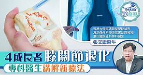 【TOPick診症室】4成長者膝關節退化　骨科專科醫生講解新療法 - 香港經濟日報 - TOPick - 健康 - 醫生診症室