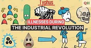 Illnesses during the Industrial Revolution - #2.5 | History made Fun
