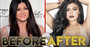 KYLIE JENNER | Before & After | Transformation ( Lips, Plastic Surgery and Workout )