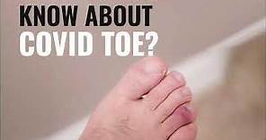 What are Covid Toe? & its Symptoms? | Apollo Hospitals