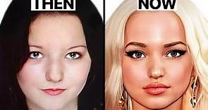 Dove Cameron's NEW FACE | Plastic Surgery Analysis