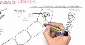 Diabetes Complication and Pathophysiology of the complication