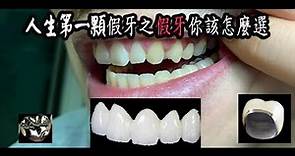 【開箱】人生第一顆假牙之假牙你該怎麼選(患者務必先看！！)