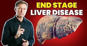 10 Signs of a Dying Liver (End Stage Liver Disease)