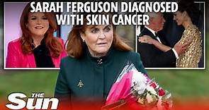 Sarah Ferguson diagnosed with aggressive skin cancer just six months after breast op