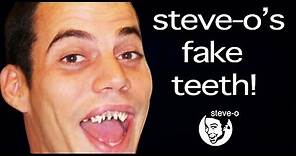The Untold Story of Steve O's Fake Teeth | Steve-O