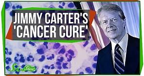 Jimmy Carter's 'Cancer Cure'