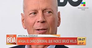 👉 Qué es la AFASIA, el daño cerebral que padece Bruce Willis