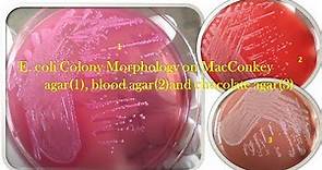 Escherichia coli Colony Morphology on Macconkey agar, blood agar and chocolate agar Demonstration