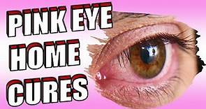16 Powerful Pink Eye Home Remedies & Treatments | How To Get Rid of Conjunctivitis