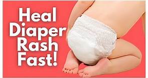 Ultimate Diaper Rash Guide - Tips For Tough Diaper Rashes