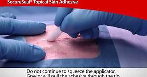 SecureSeal® Topical Skin Adhesive | Cardinal Health