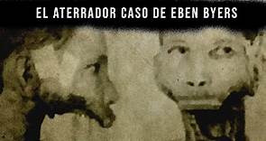 El aterrador caso de Eben Byers - El hombre sin mandíbula