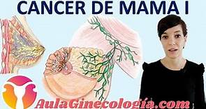 CÁNCER DE MAMA: FACTORES DE RIESGO, ANATOMÍA, SÍNTOMAS, DIAGNÓSTICO... - Ginecología y Obstetricia -