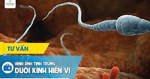 Hình ảnh tinh trùng dưới kính hiển vi